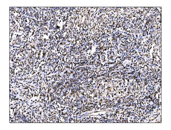 ornithine aminotransferase/OAT Rabbit Polyclonal Antibody