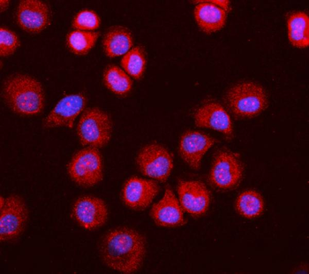 MGEA5/OGA Rabbit Polyclonal Antibody