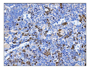 MGEA5/OGA Rabbit Polyclonal Antibody