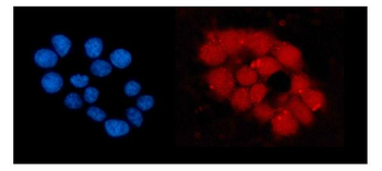 ORC5L/ORC5 Rabbit Polyclonal Antibody