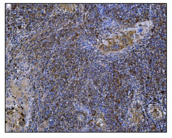 POGLUT1 Rabbit Polyclonal Antibody