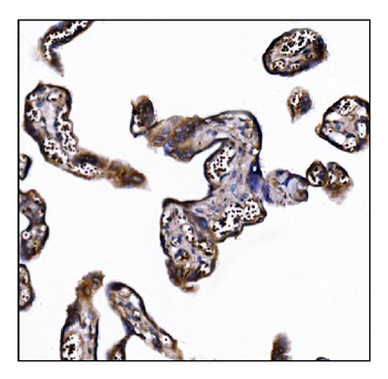 POGLUT1 Rabbit Polyclonal Antibody