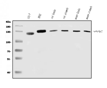 PPP4R1 Rabbit Polyclonal Antibody