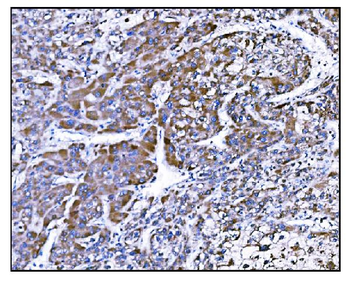 Prolyl Endopeptidase/PREP Antibody