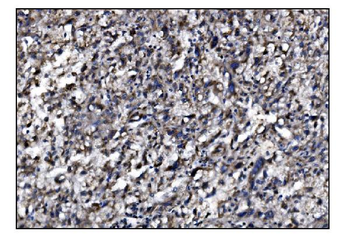 SLFN11 Antibody