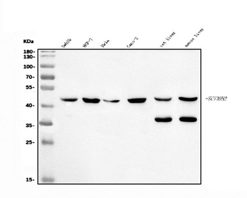 KMT1B/SUV39H2 Rabbit Polyclonal Antibody