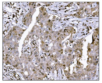 KMT1B/SUV39H2 Rabbit Polyclonal Antibody