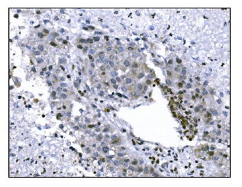 KMT1B/SUV39H2 Rabbit Polyclonal Antibody