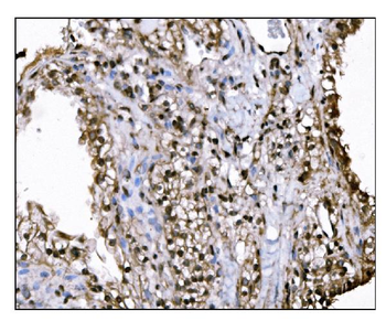 KMT1B/SUV39H2 Rabbit Polyclonal Antibody
