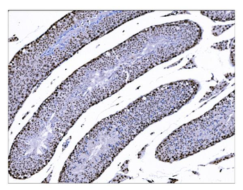 KMT1B/SUV39H2 Rabbit Polyclonal Antibody