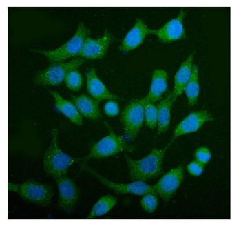 AS160/TBC1D4 Rabbit Polyclonal Antibody
