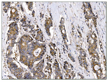 AS160/TBC1D4 Rabbit Polyclonal Antibody