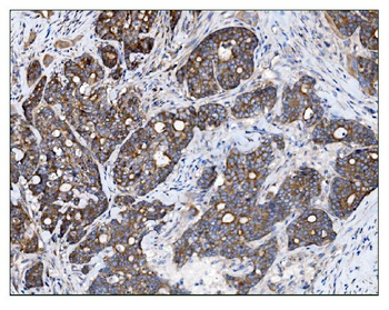 AS160/TBC1D4 Rabbit Polyclonal Antibody