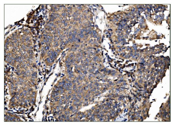 AS160/TBC1D4 Rabbit Polyclonal Antibody
