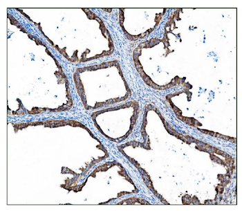 AS160/TBC1D4 Rabbit Polyclonal Antibody