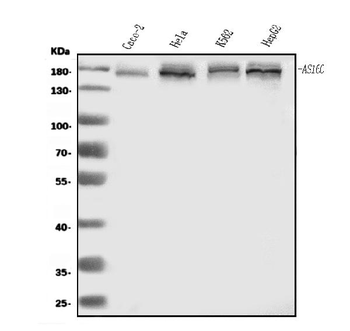 AS160/TBC1D4 Rabbit Polyclonal Antibody