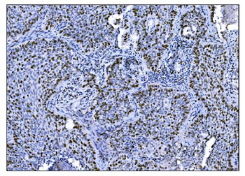 Ki67 Antibody (monoclonal, 5E12)