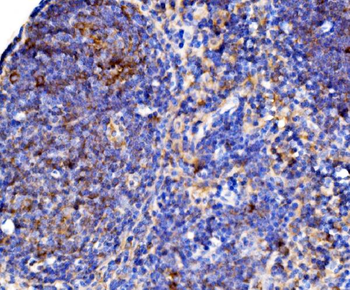 Cd38 Rabbit Polyclonal Antibody