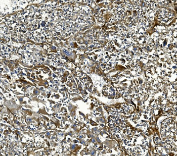 COL4A3 Rabbit Polyclonal Antibody