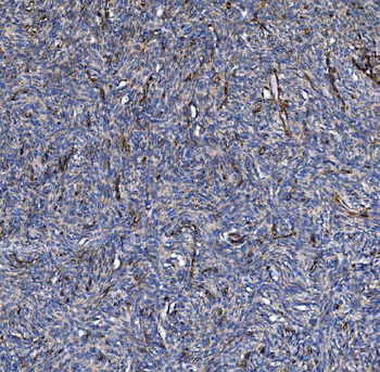 COL4A3 Rabbit Polyclonal Antibody