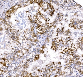 COX6B1 Rabbit Polyclonal Antibody