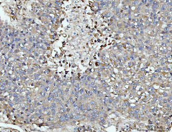 DUSP6 Rabbit Polyclonal Antibody