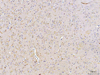 DUSP6 Rabbit Polyclonal Antibody