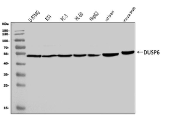 DUSP6 Rabbit Polyclonal Antibody