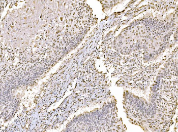 c-Jun/JUN Rabbit Polyclonal Antibody