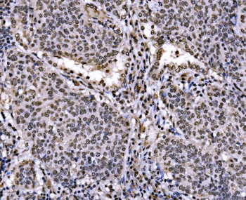c-Jun/JUN Rabbit Polyclonal Antibody