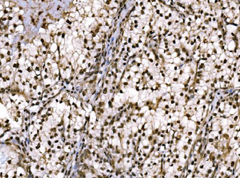 c-Jun/JUN Rabbit Polyclonal Antibody