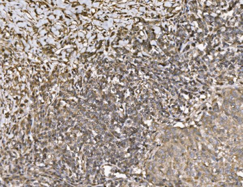 KIF2A Rabbit Polyclonal Antibody