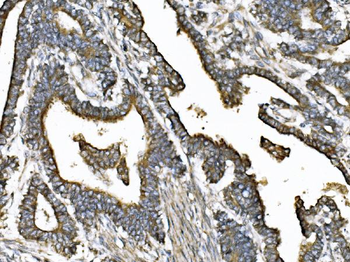 KIF2A Rabbit Polyclonal Antibody