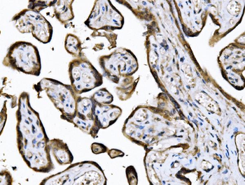 KIF2A Rabbit Polyclonal Antibody