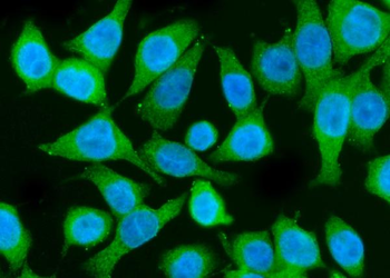 PI 3 Kinase p85 alpha/PIK3R1 Rabbit Polyclonal Antibody