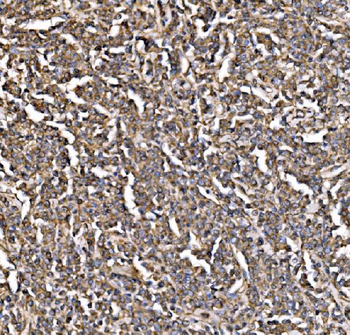 PI 3 Kinase p85 alpha/PIK3R1 Rabbit Polyclonal Antibody