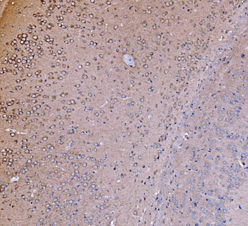 PI 3 Kinase p85 alpha/PIK3R1 Rabbit Polyclonal Antibody