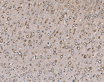 PI 3 Kinase p85 alpha/PIK3R1 Rabbit Polyclonal Antibody