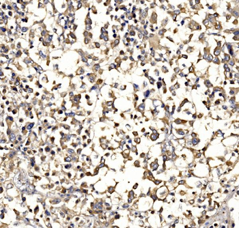 Epac1/RAPGEF3 Rabbit Polyclonal Antibody