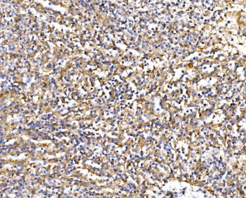 Epac1/RAPGEF3 Rabbit Polyclonal Antibody