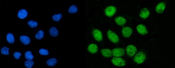 CoREST/RCOR1 Rabbit Polyclonal Antibody