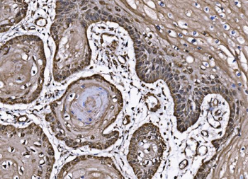 CoREST/RCOR1 Rabbit Polyclonal Antibody