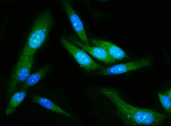 GSDMD Mouse Monoclonal Antibody