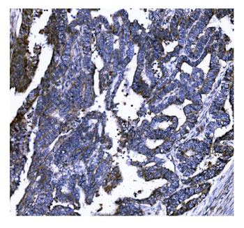 GSDMD Mouse Monoclonal Antibody