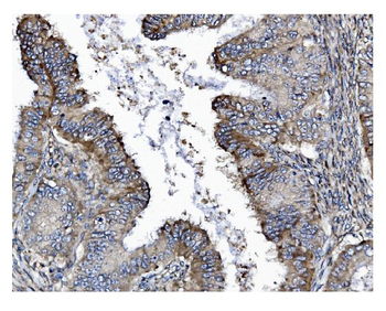 GSDMD Mouse Monoclonal Antibody