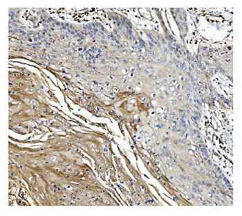 GSDMD Mouse Monoclonal Antibody