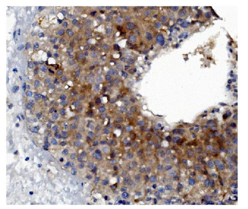 GSDMD Mouse Monoclonal Antibody