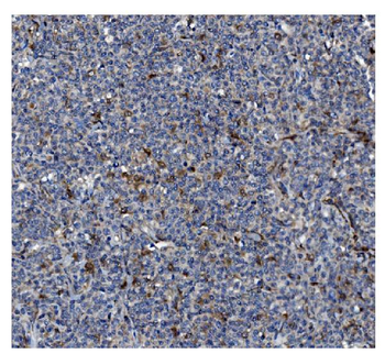 GSDMD Mouse Monoclonal Antibody