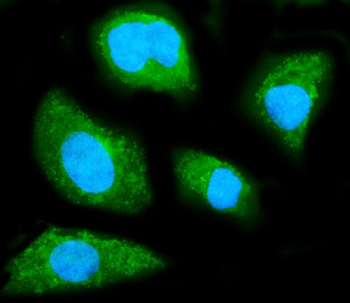 GNB1 Mouse Monoclonal Antibody