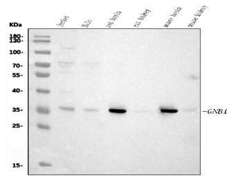 GNB1 Mouse Monoclonal Antibody